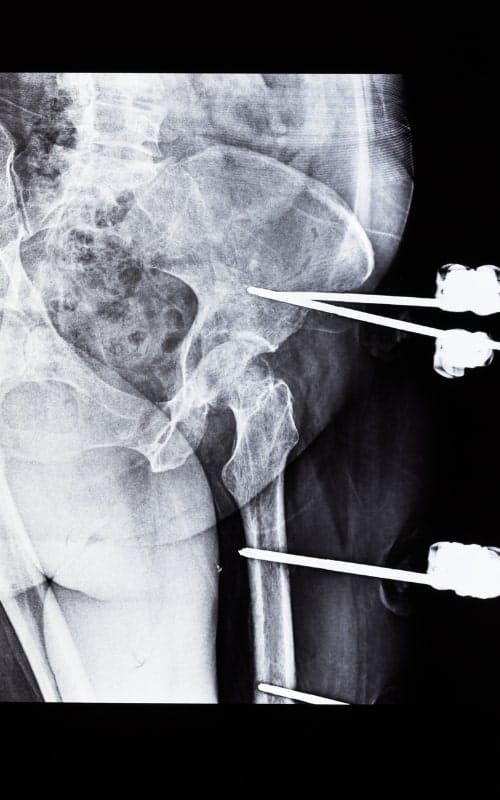 Orthopedic Device Executive